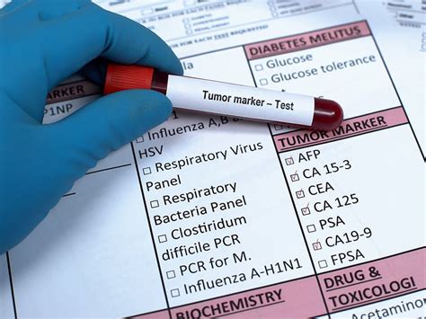 red drop test for cancer|elevated blood test for cancer.